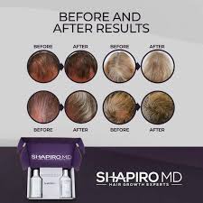 Shapiro MD Hair Regrowth System Kit